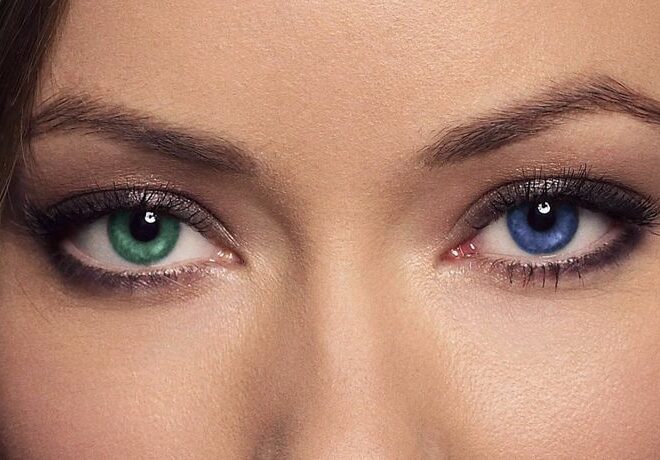 Gözünüzü qurban verməyin – Bu əməliyyat korluq yaradır