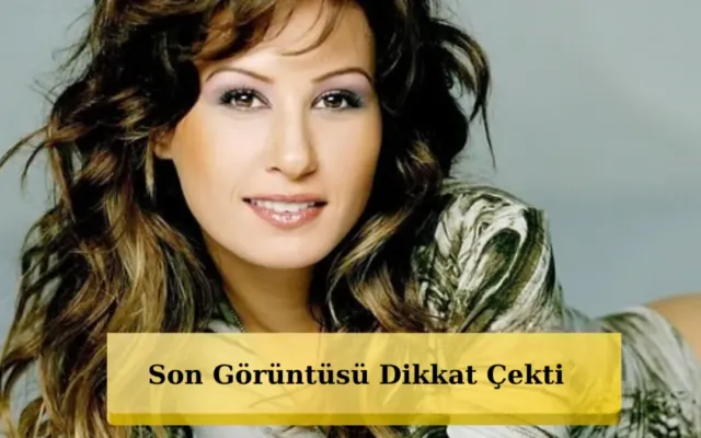 Nalanın illər içindəki dəyişimi diqqət çəkdi