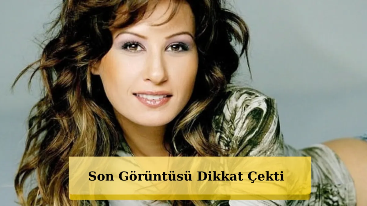 Nalanın illər içindəki dəyişimi diqqət çəkdi